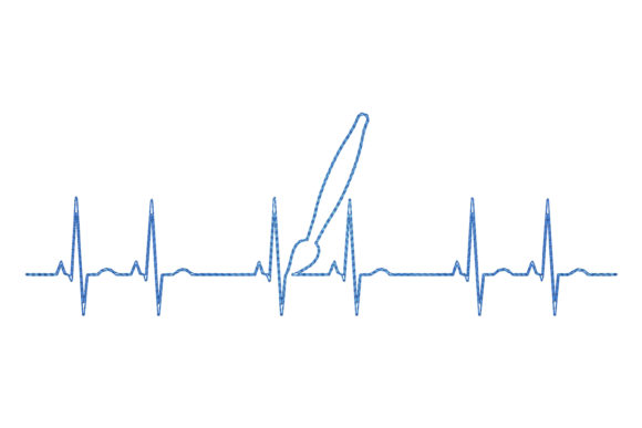 Pen Line
